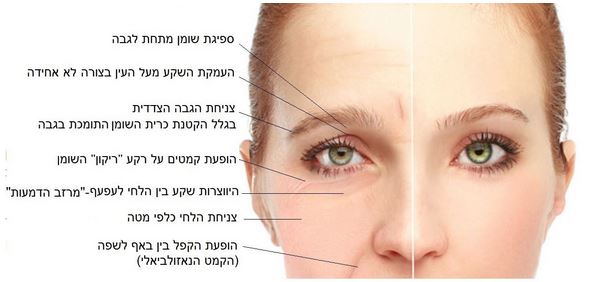 עיגולים שחורים מסביב לעיניים
